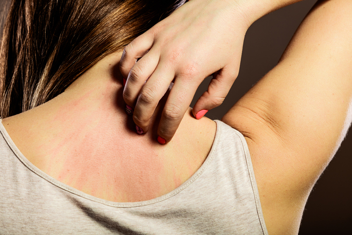 Simptomi i znaci na koži koji mogu ukazivati na ozbiljne bolesti