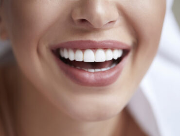 Ovih 5 jednostavnih saveta će vam pomoći da zaštitite zube