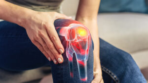 5 uzroka bolova u kolenu i na koje načine mogu da se ublaže tegobe?