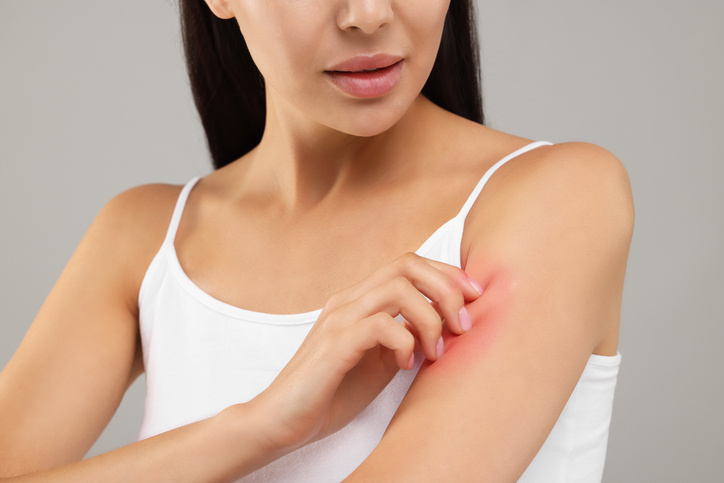Infekcije kože: 5 kučnih lekova koji mogu da donesu olakšanje