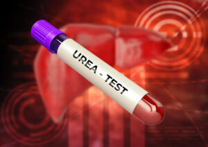 Urea u krvi otkriva u kakvom su stanju bubrezi: Šta je BUN test i koje su normalne vrednosti? 